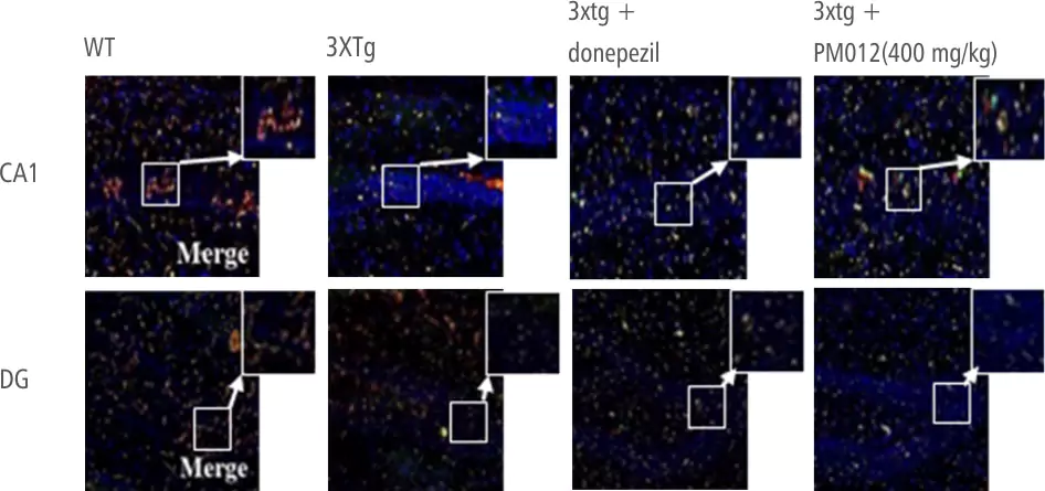 PM-012 PET Imaging Neurogenesis in CA1 DG Regions of Hippocampus